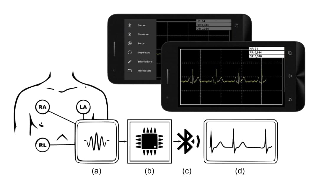 Portable Electrocardiogram (ECG) and Heart Rate Monitoring System Using an Android Smartphone
